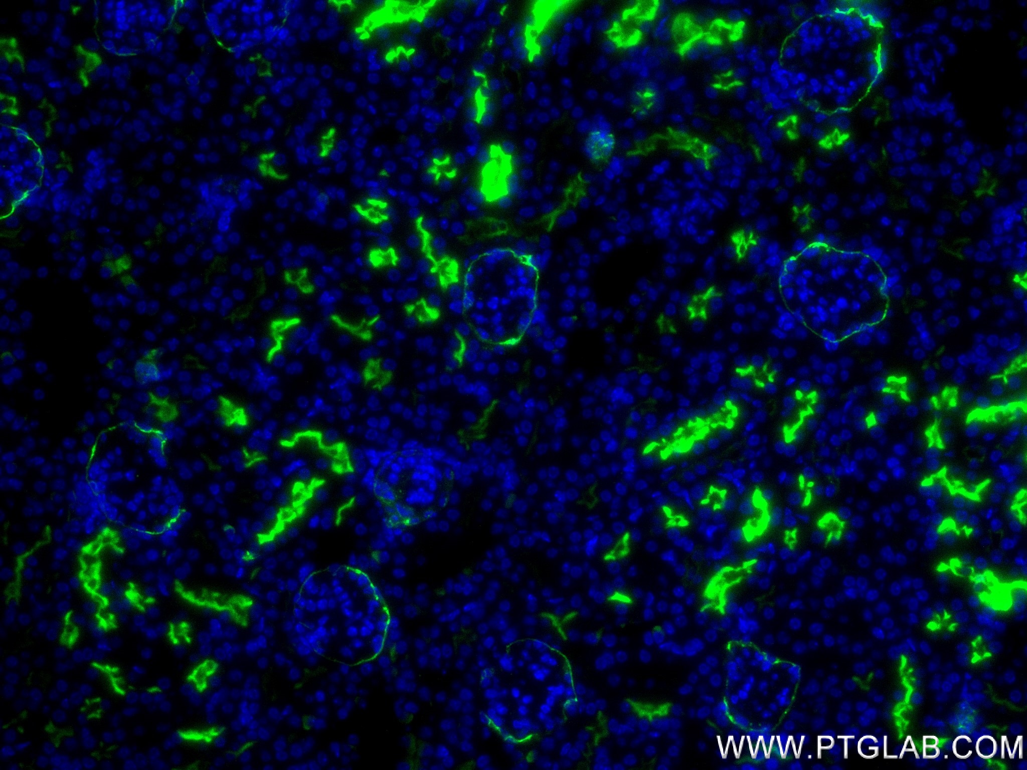 IF Staining of mouse kidney using 84181-1-RR (same clone as 84181-1-PBS)