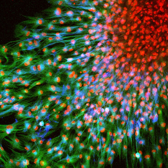 IF Staining of human dental pulp stem cells using CL488-19483