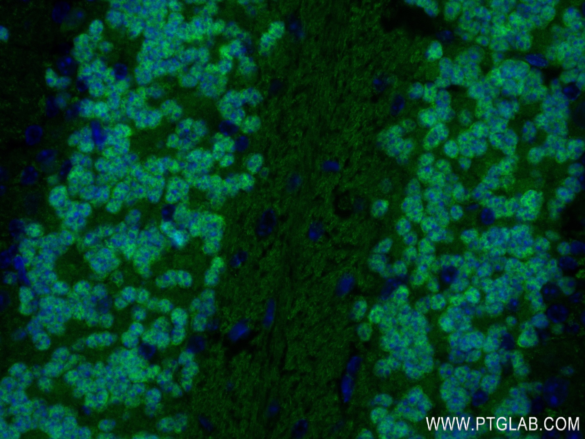 IF Staining of mouse cerebellum using 84401-4-RR