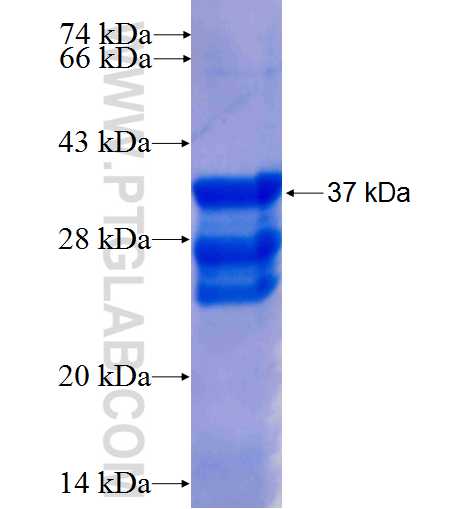 Neurocan fusion protein Ag25821 SDS-PAGE