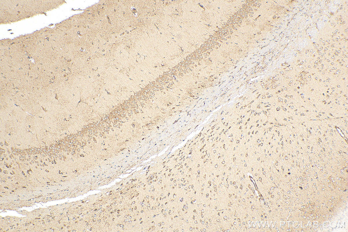 IHC staining of mouse brain using 27249-1-AP