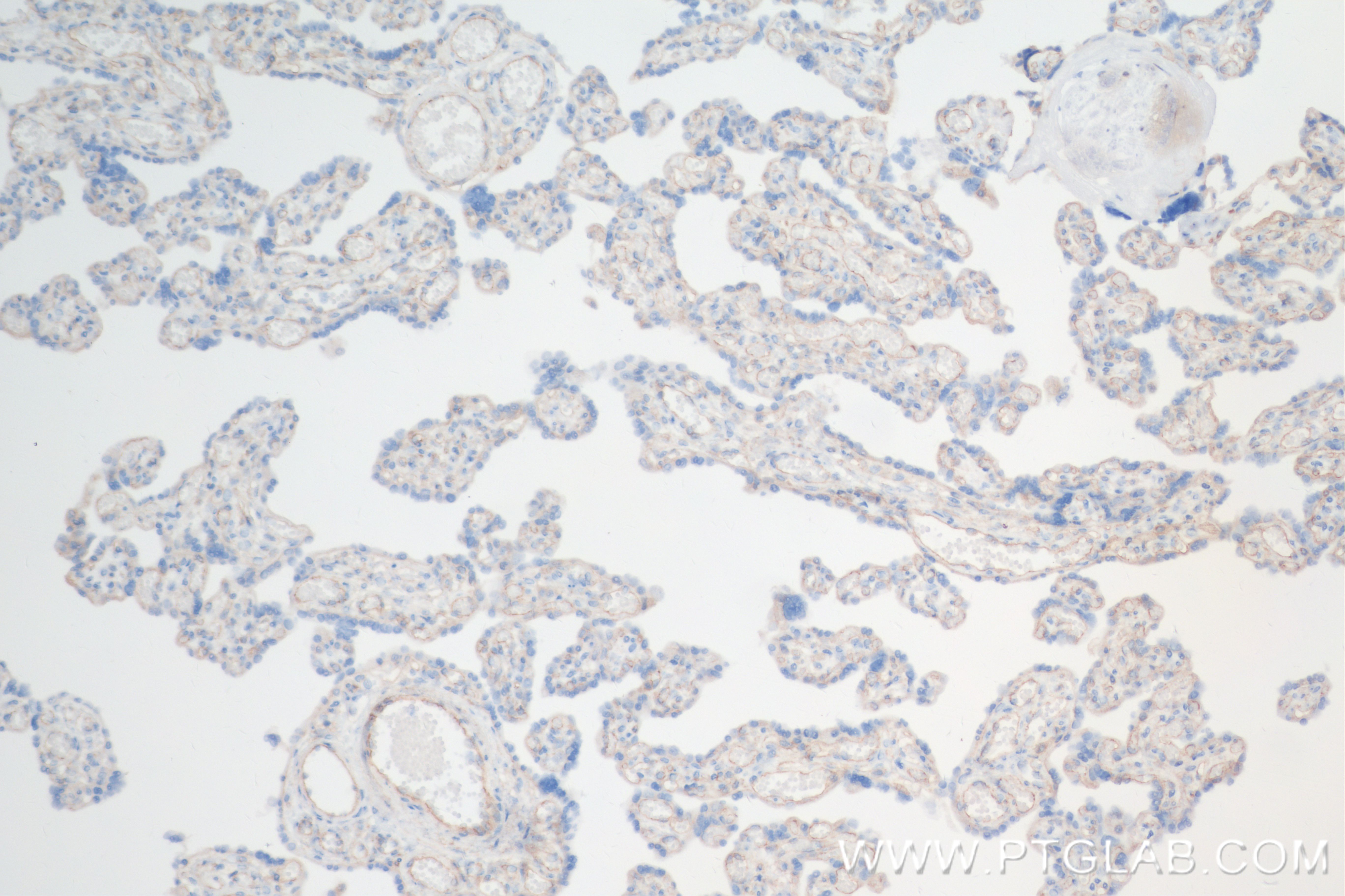 IHC staining of human placenta using 84429-5-RR (same clone as 84429-5-PBS)