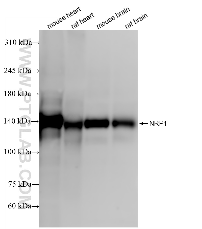 Neuropilin 1