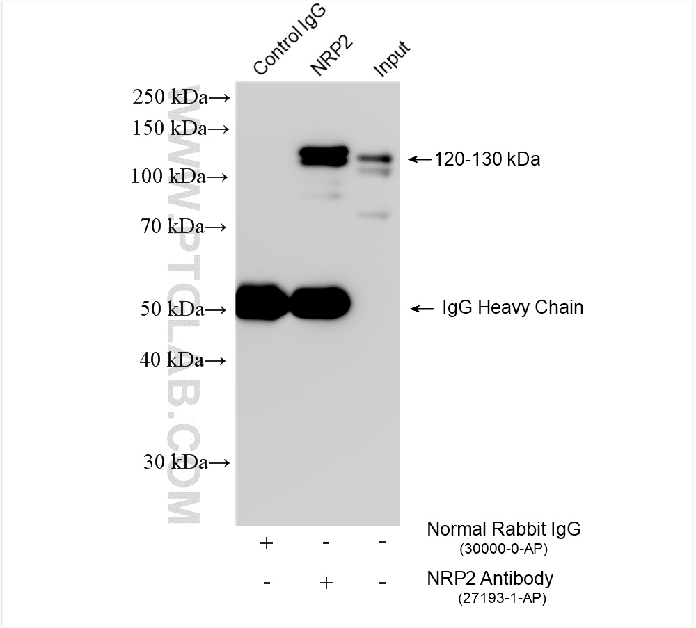 IP experiment of U-87 MG using 27193-1-AP