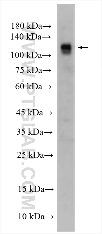 WB analysis of U-87 MG using 27193-1-AP