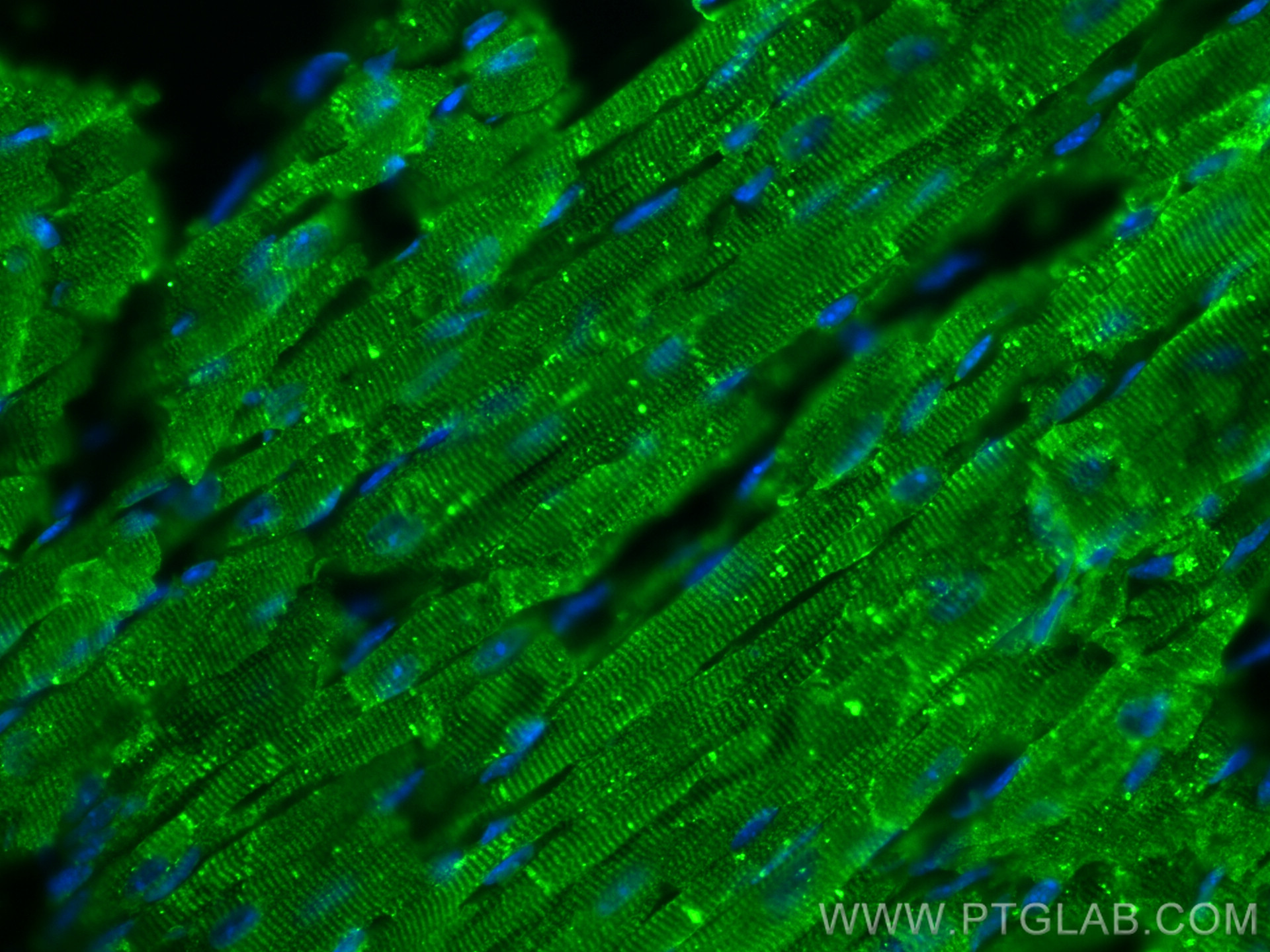 IF Staining of mouse heart using 27737-1-AP