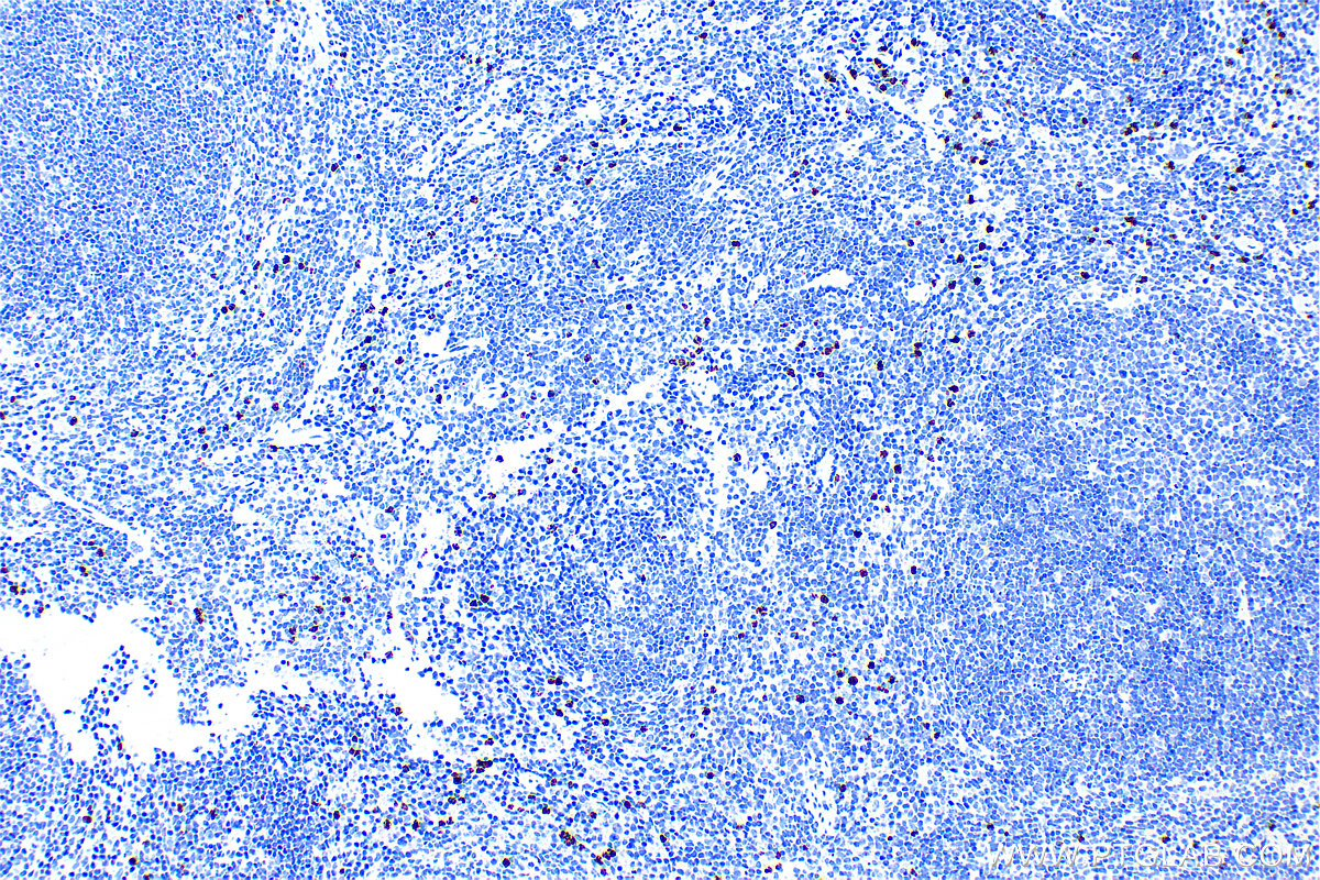 IHC staining of mouse spleen using 83102-1-RR (same clone as 83102-1-PBS)