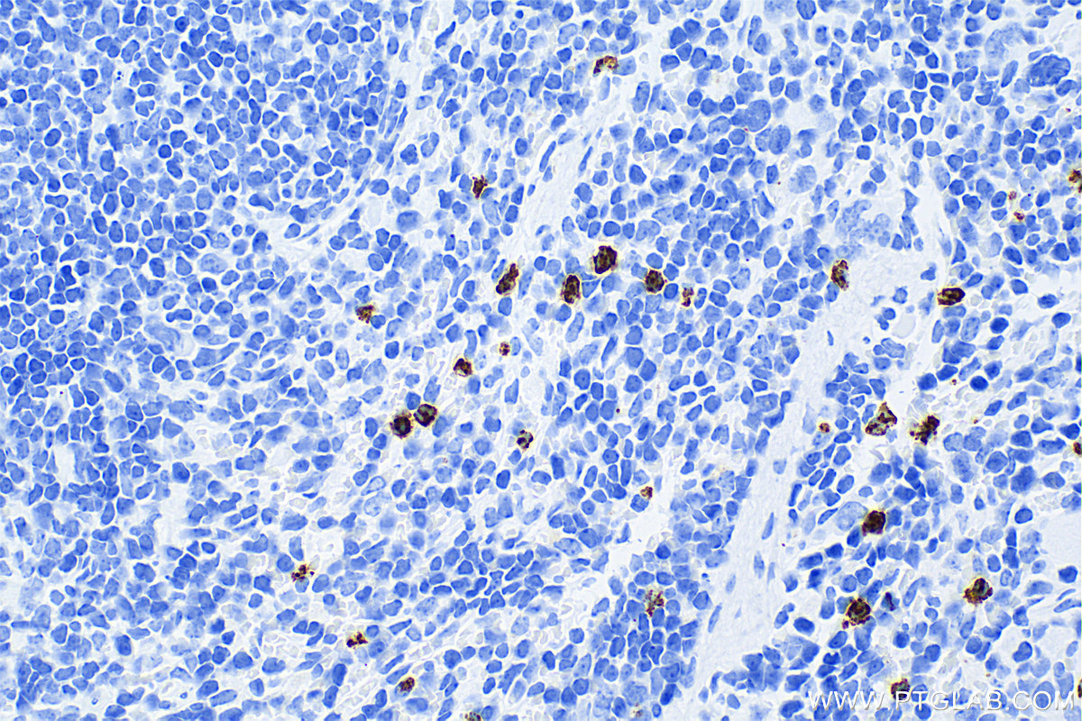 IHC staining of mouse spleen using 83102-1-RR (same clone as 83102-1-PBS)