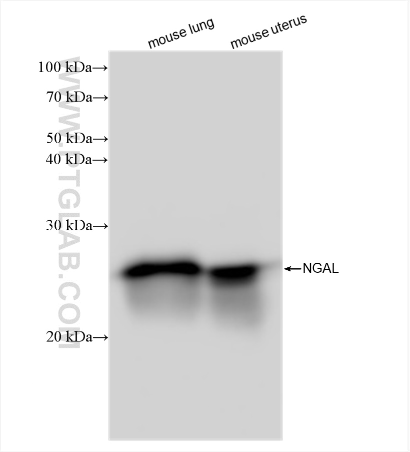 WB analysis using 83102-1-RR (same clone as 83102-1-PBS)