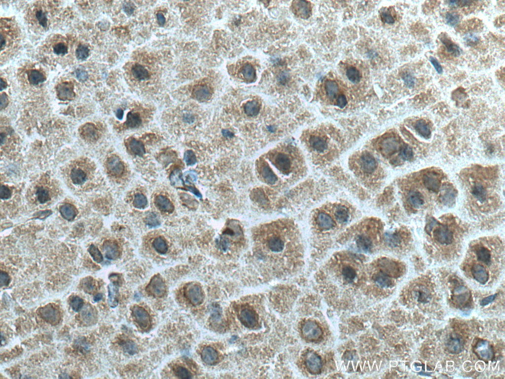 IHC staining of mouse brain using 67132-1-Ig (same clone as 67132-1-PBS)