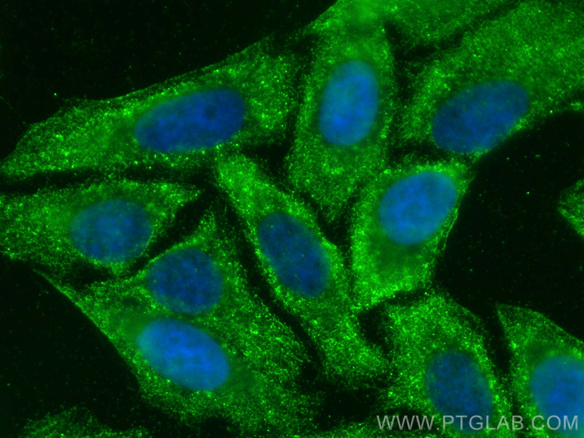 IF Staining of HepG2 using 30109-1-AP