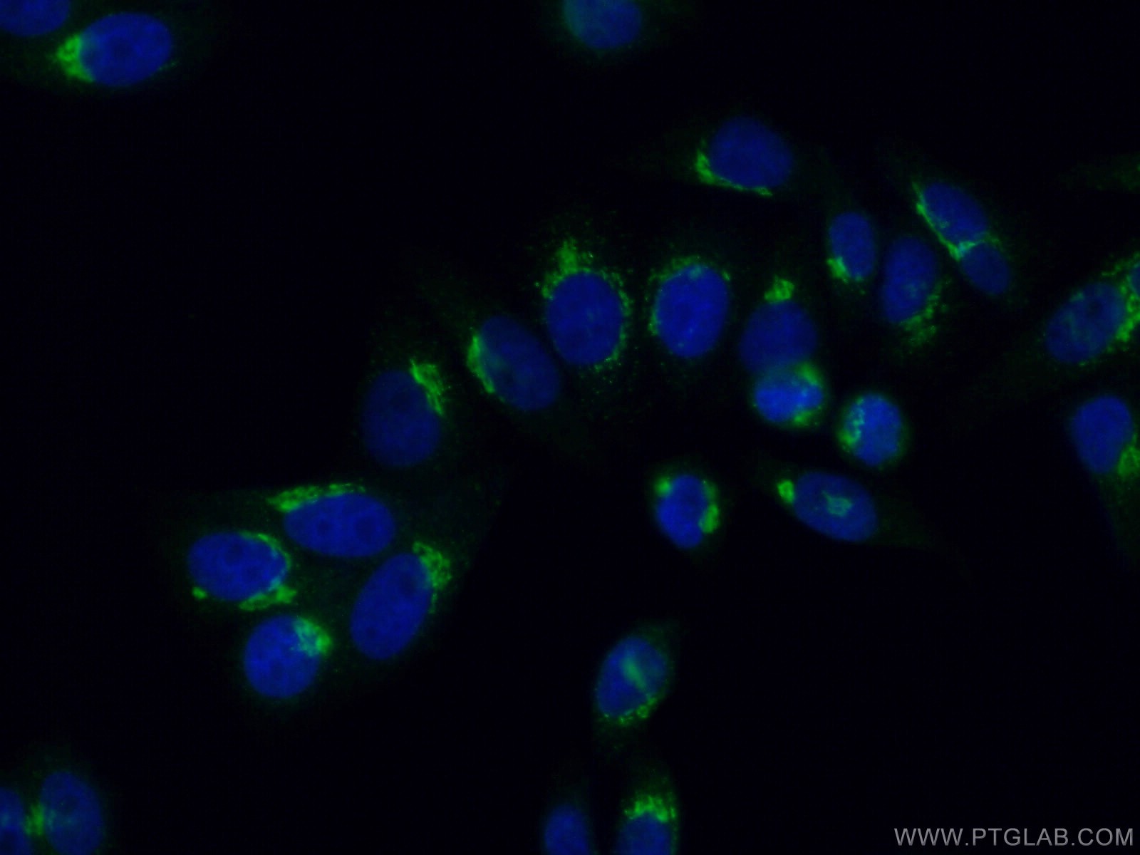 NUCB2/nesfatin-1