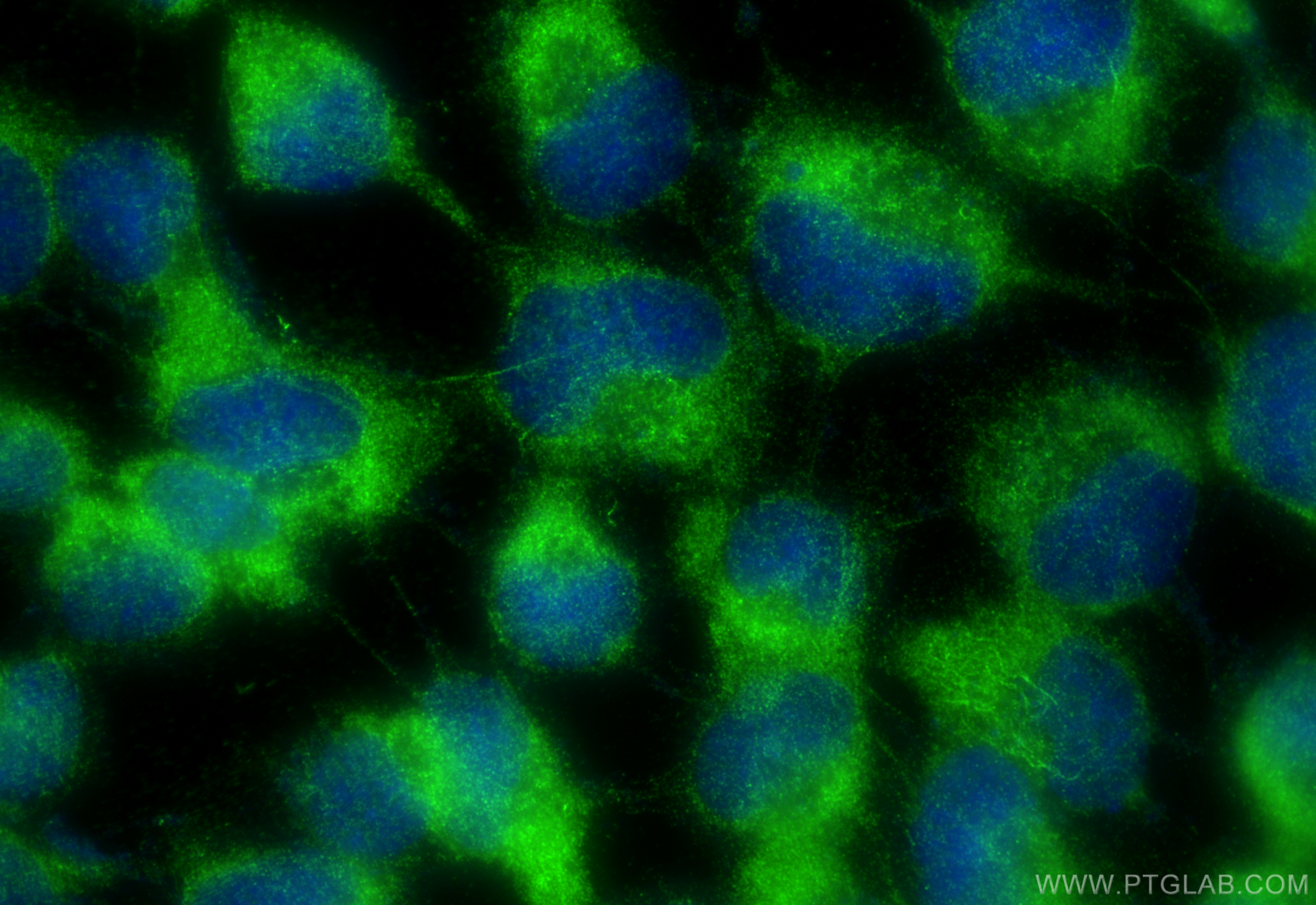 IF Staining of A431 using 14955-1-AP