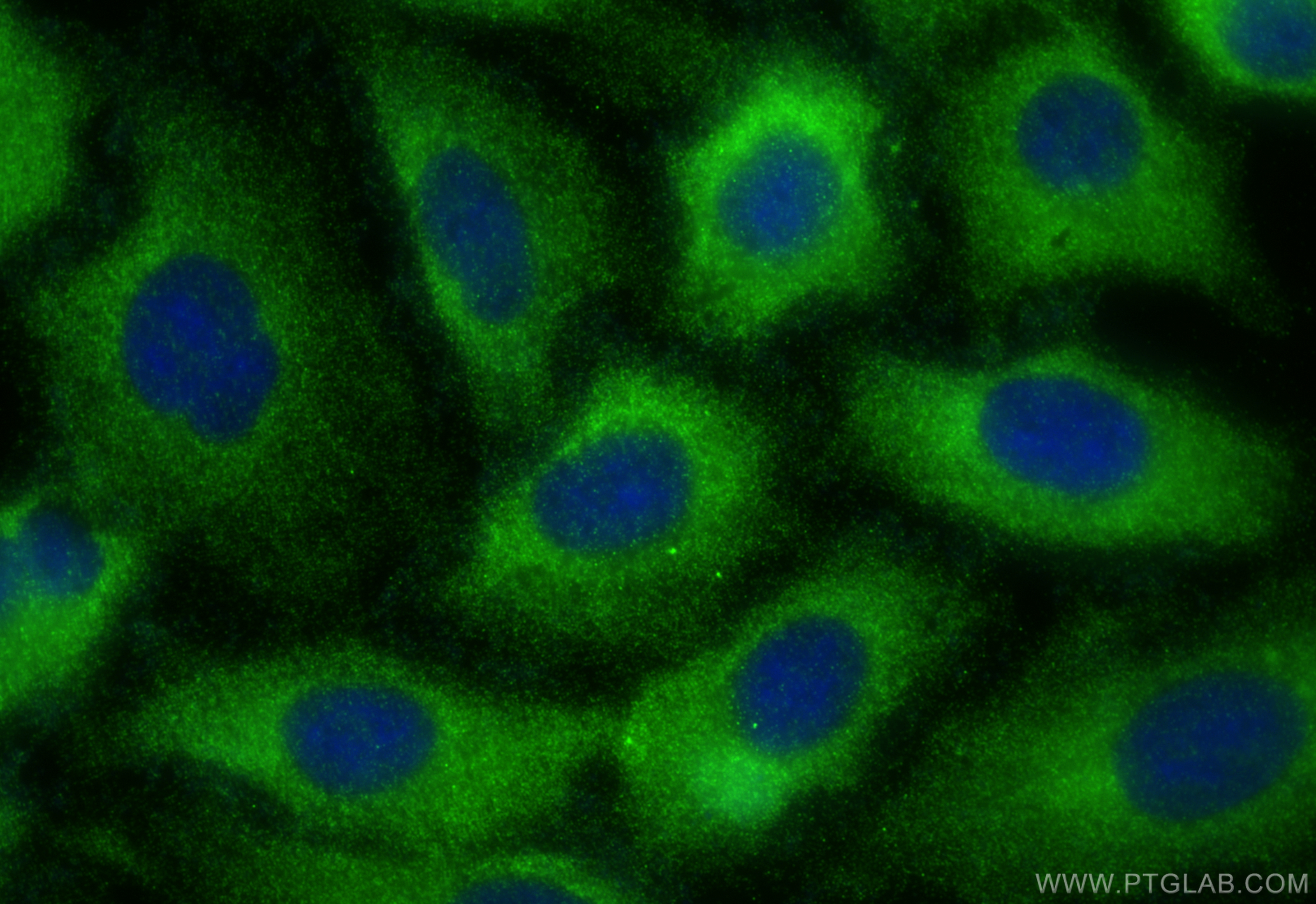 IF Staining of A549 using 21915-1-AP