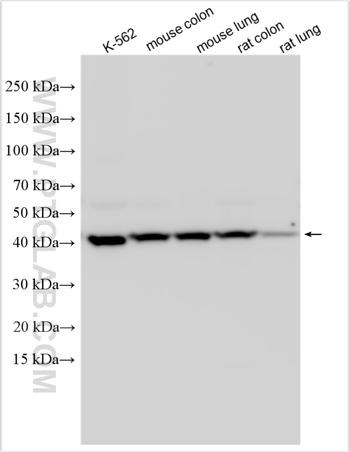 WB analysis using 17089-1-AP