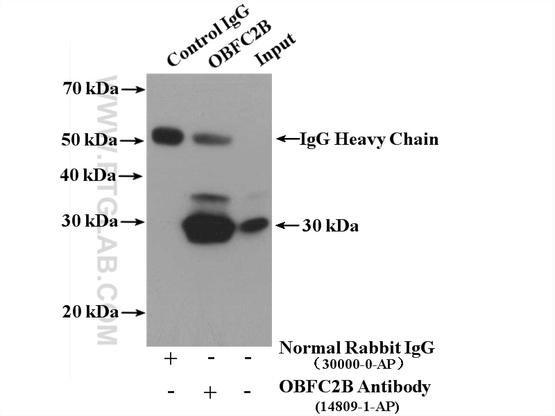 IP experiment of HeLa using 14809-1-AP