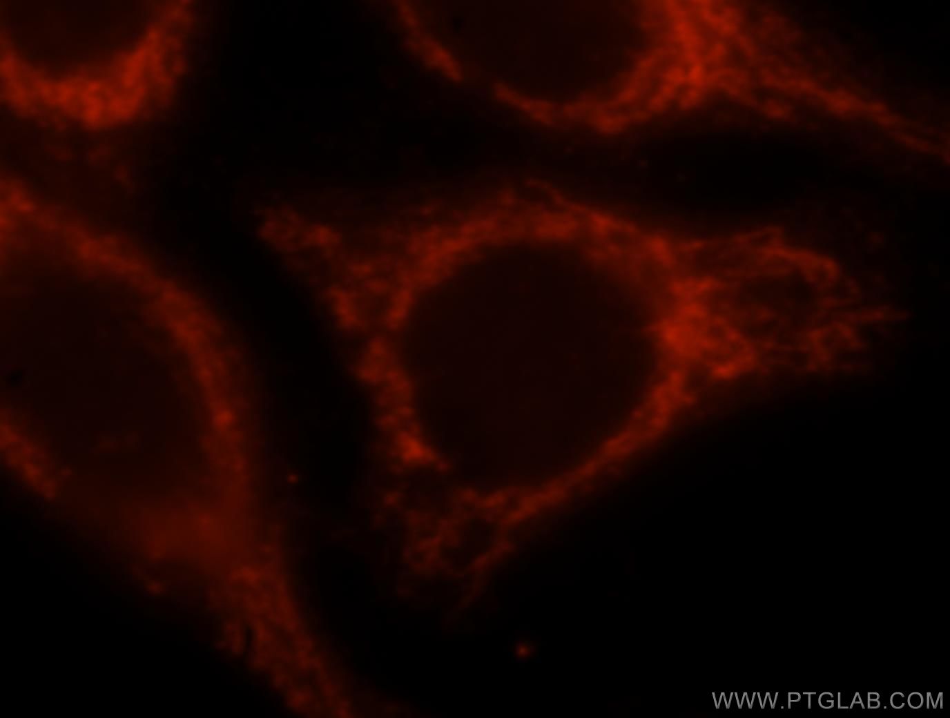 IF Staining of HepG2 using 16634-1-AP