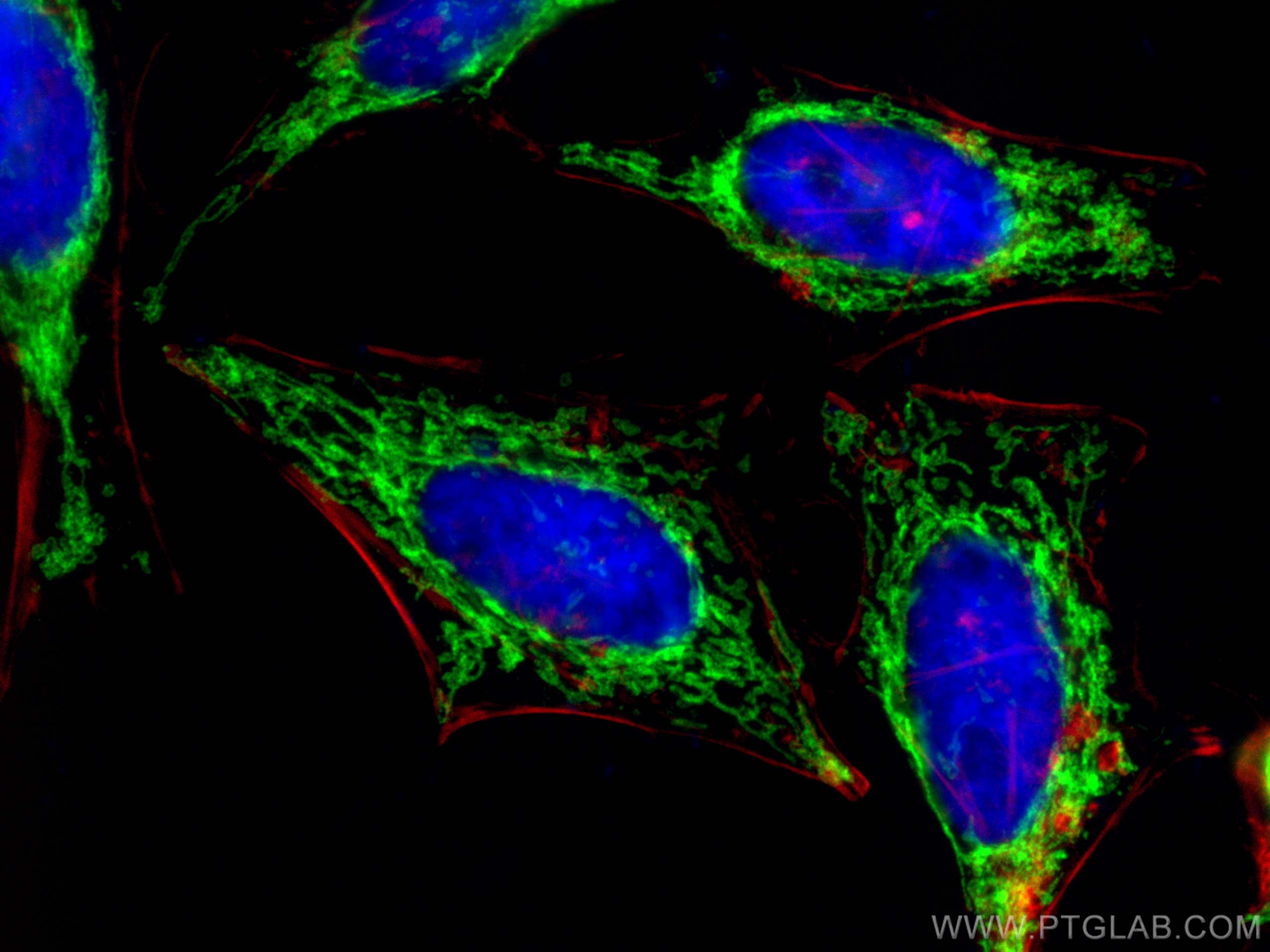 IF Staining of HeLa using 66698-1-Ig (same clone as 66698-1-PBS)