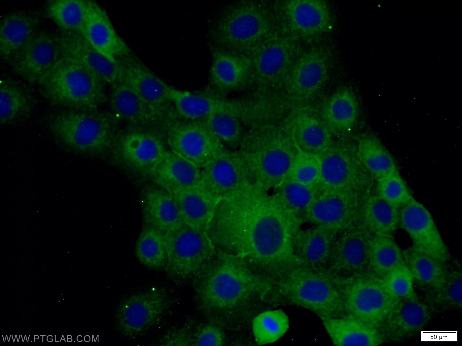 Occludin Polyclonal antibody