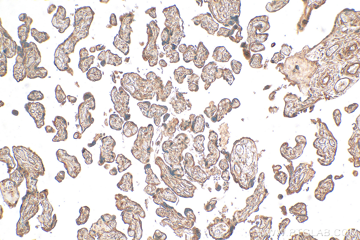 IHC staining of human placenta using 21650-1-AP