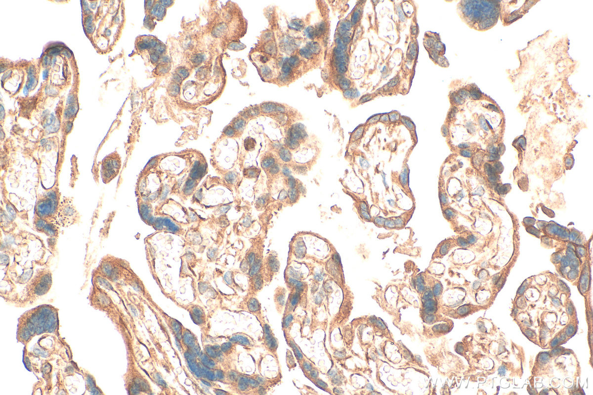 IHC staining of human placenta using 21650-1-AP