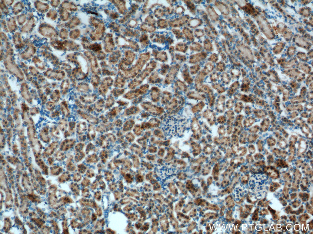 IHC staining of mouse kidney using 17695-1-AP