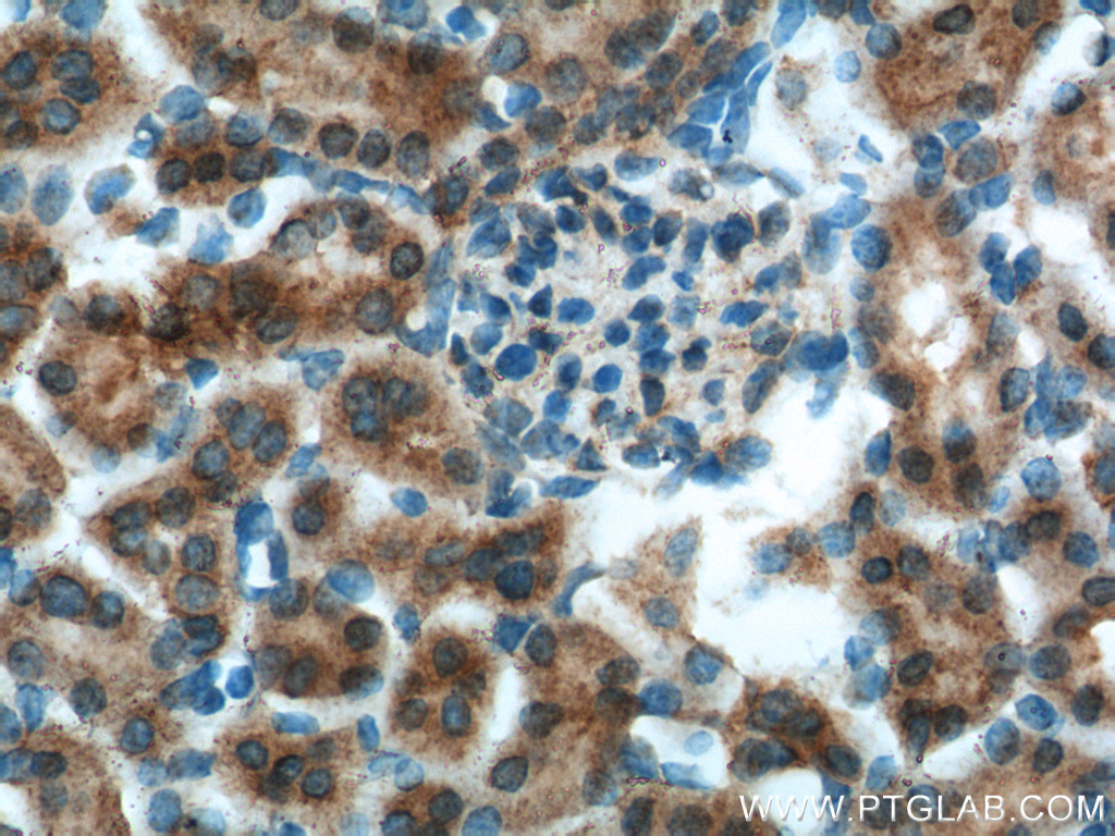 IHC staining of mouse kidney using 17695-1-AP