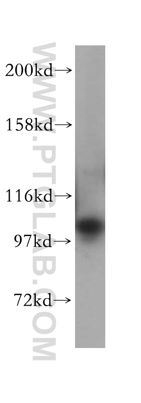 WB analysis of HeLa using 17695-1-AP