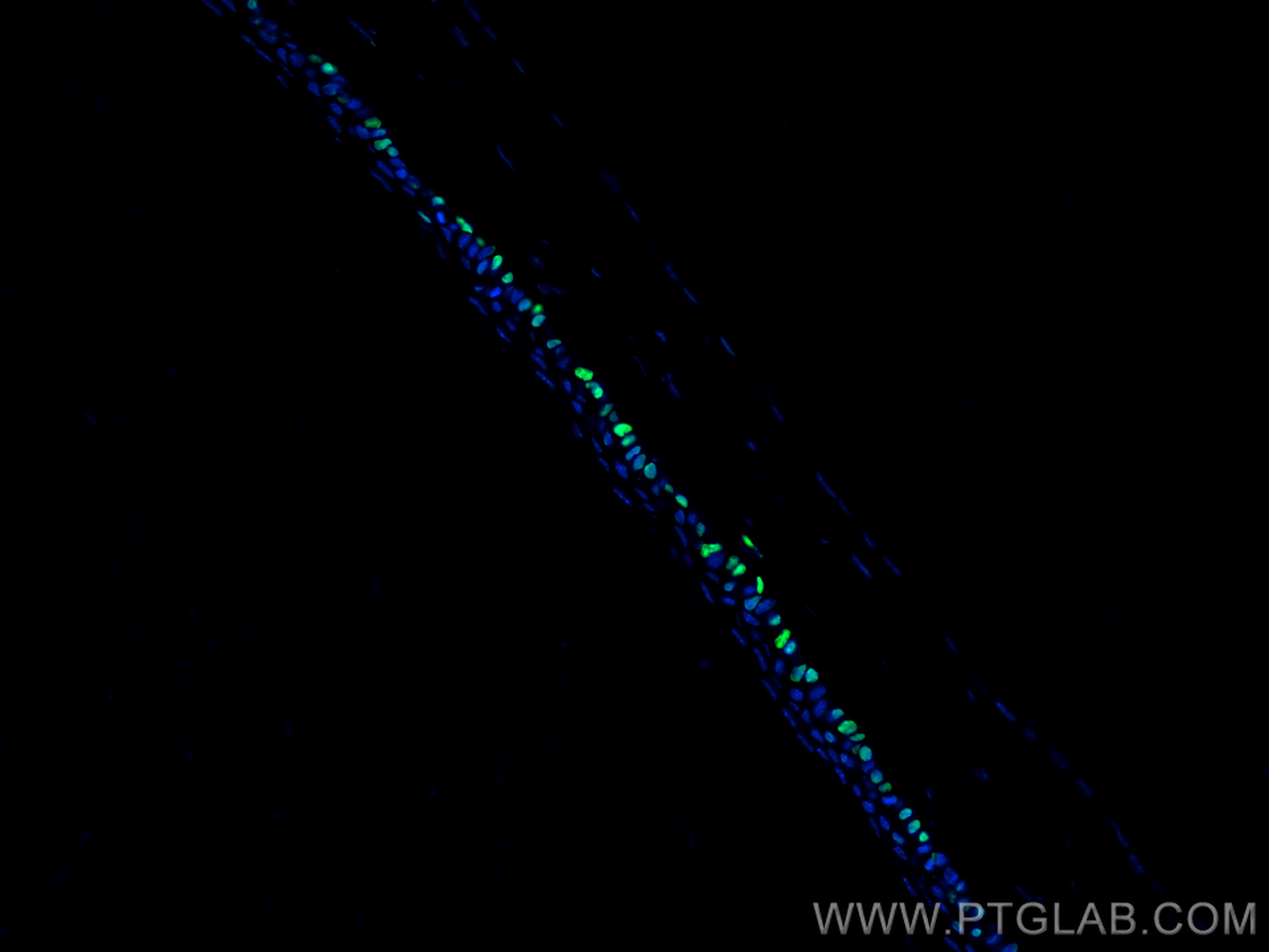 IF Staining of mouse eye using 11263-1-AP (same clone as 11263-1-PBS)