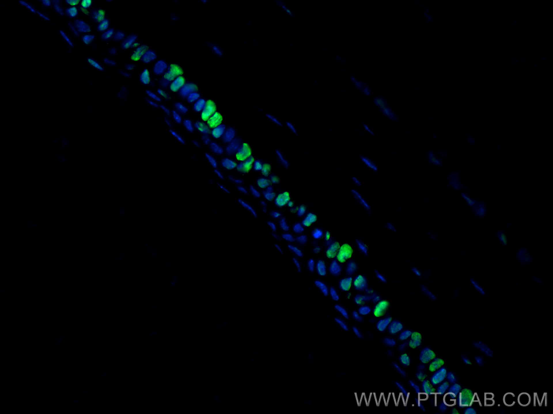 IF Staining of mouse eye using 11263-1-AP