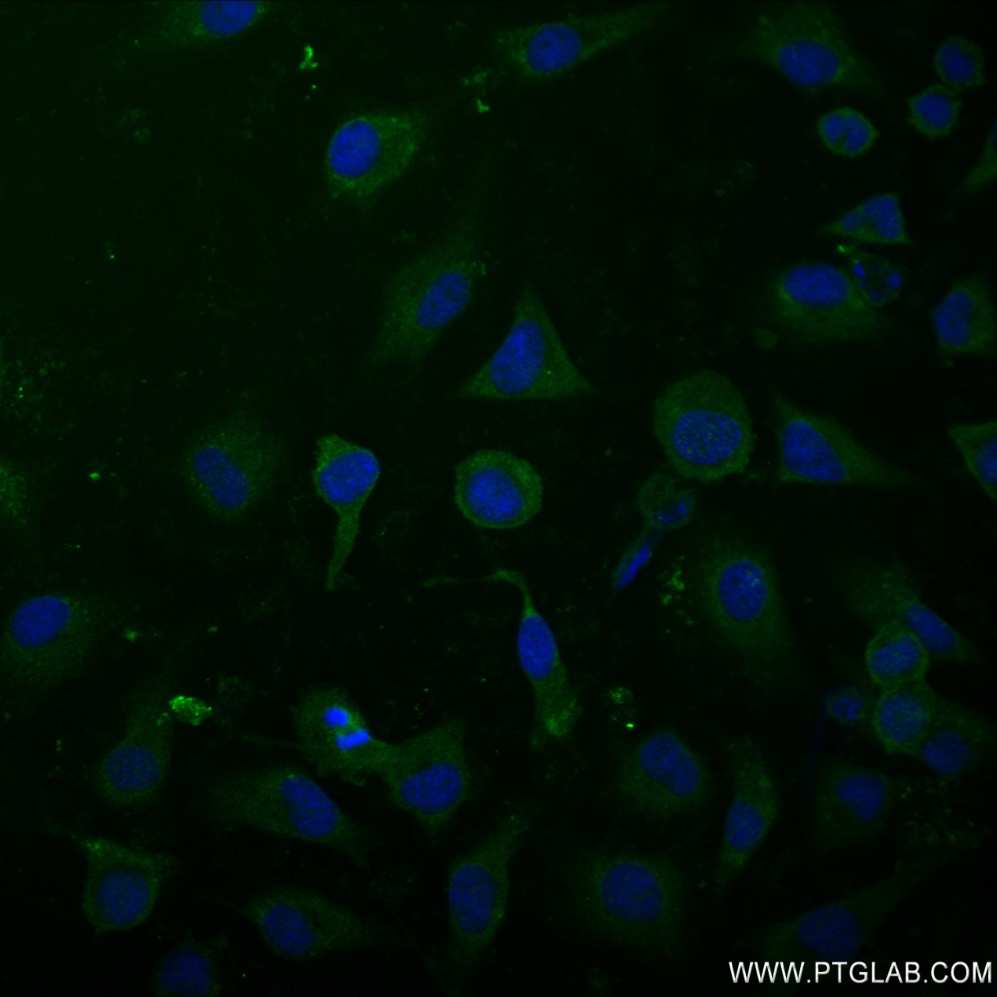 IF Staining of HeLa using 83108-1-RR (same clone as 83108-1-PBS)