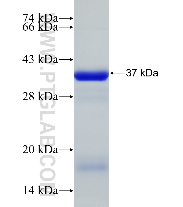 ODF2 fusion protein Ag33139 SDS-PAGE