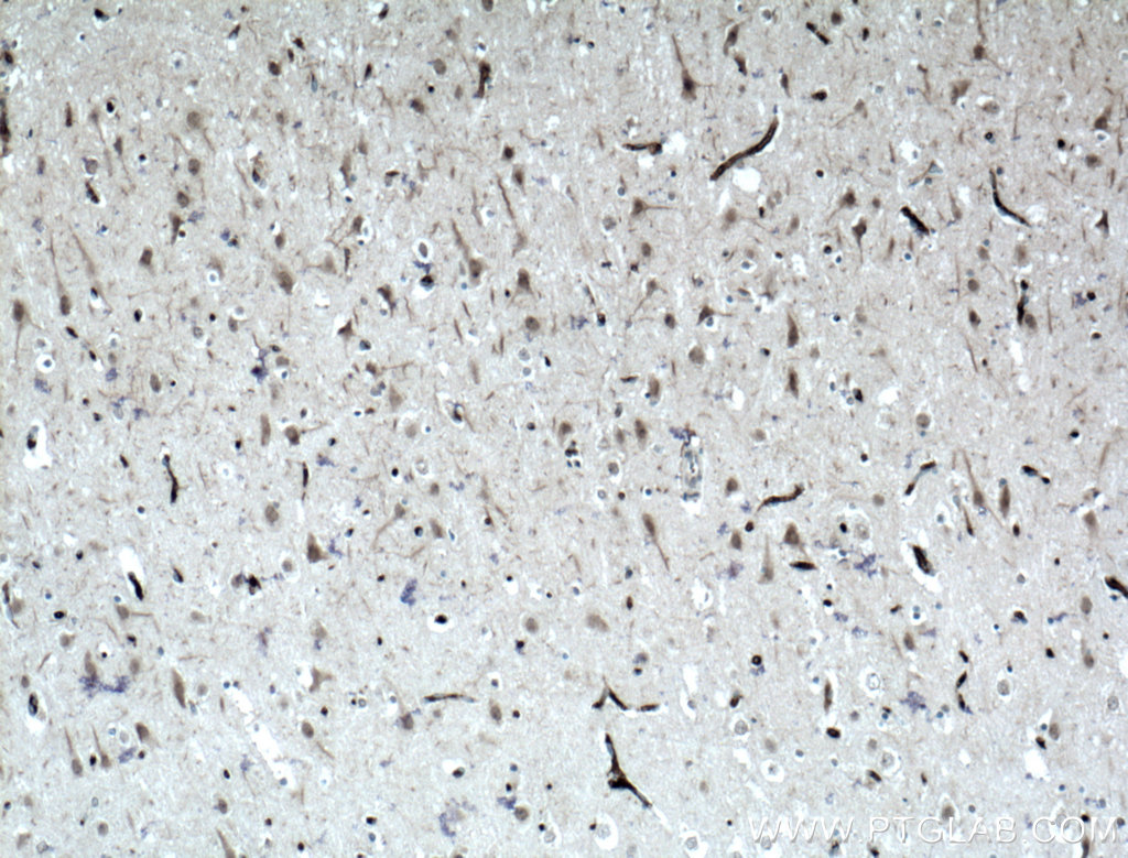 IHC staining of human brain using 21696-1-AP