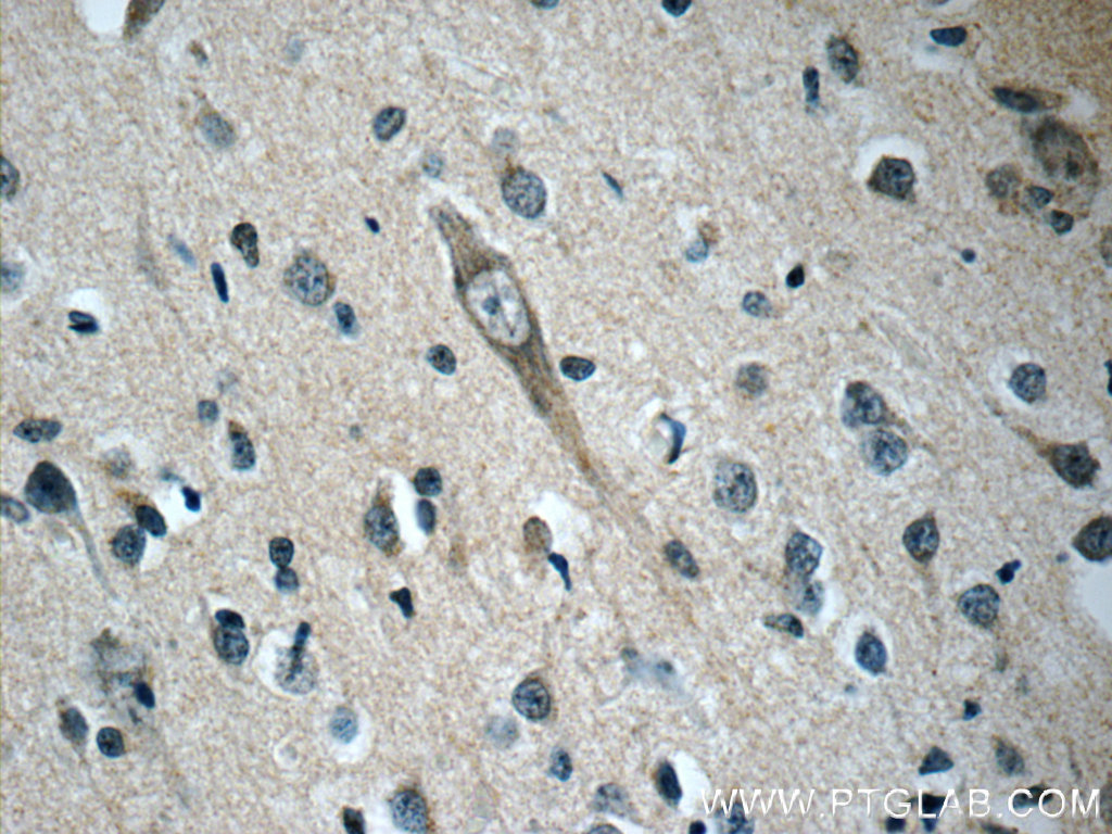 IHC staining of human brain using 22851-1-AP