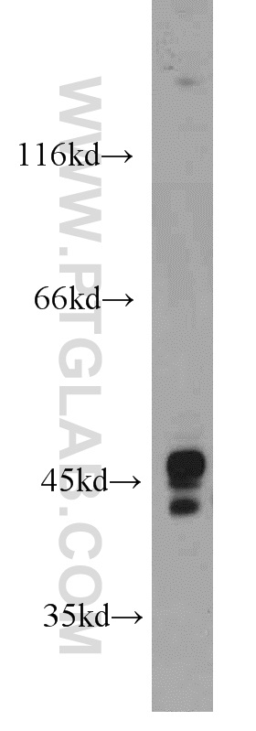 WB analysis of HeLa using 22851-1-AP