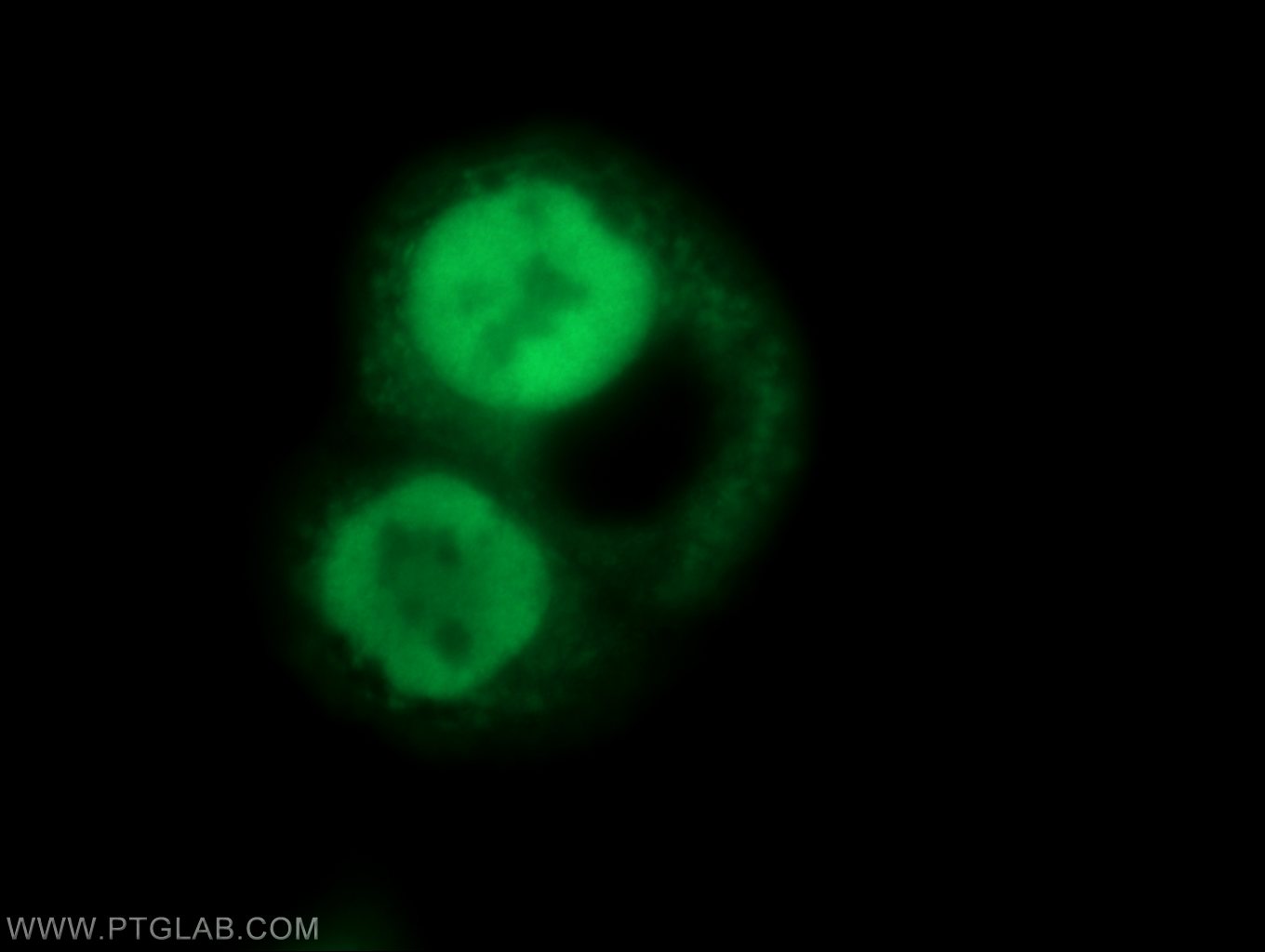 IF Staining of COLO 320 using 11177-1-AP