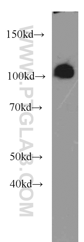 WB analysis of COLO 320 using 11177-1-AP