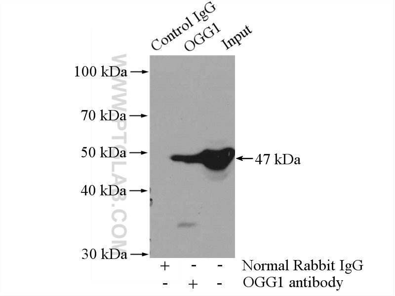 IP experiment of mouse heart using 15125-1-AP