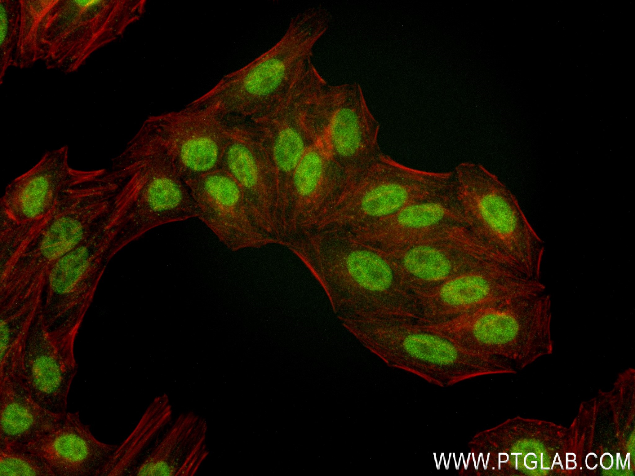 IF Staining of HepG2 using 83973-4-RR (same clone as 83973-4-PBS)