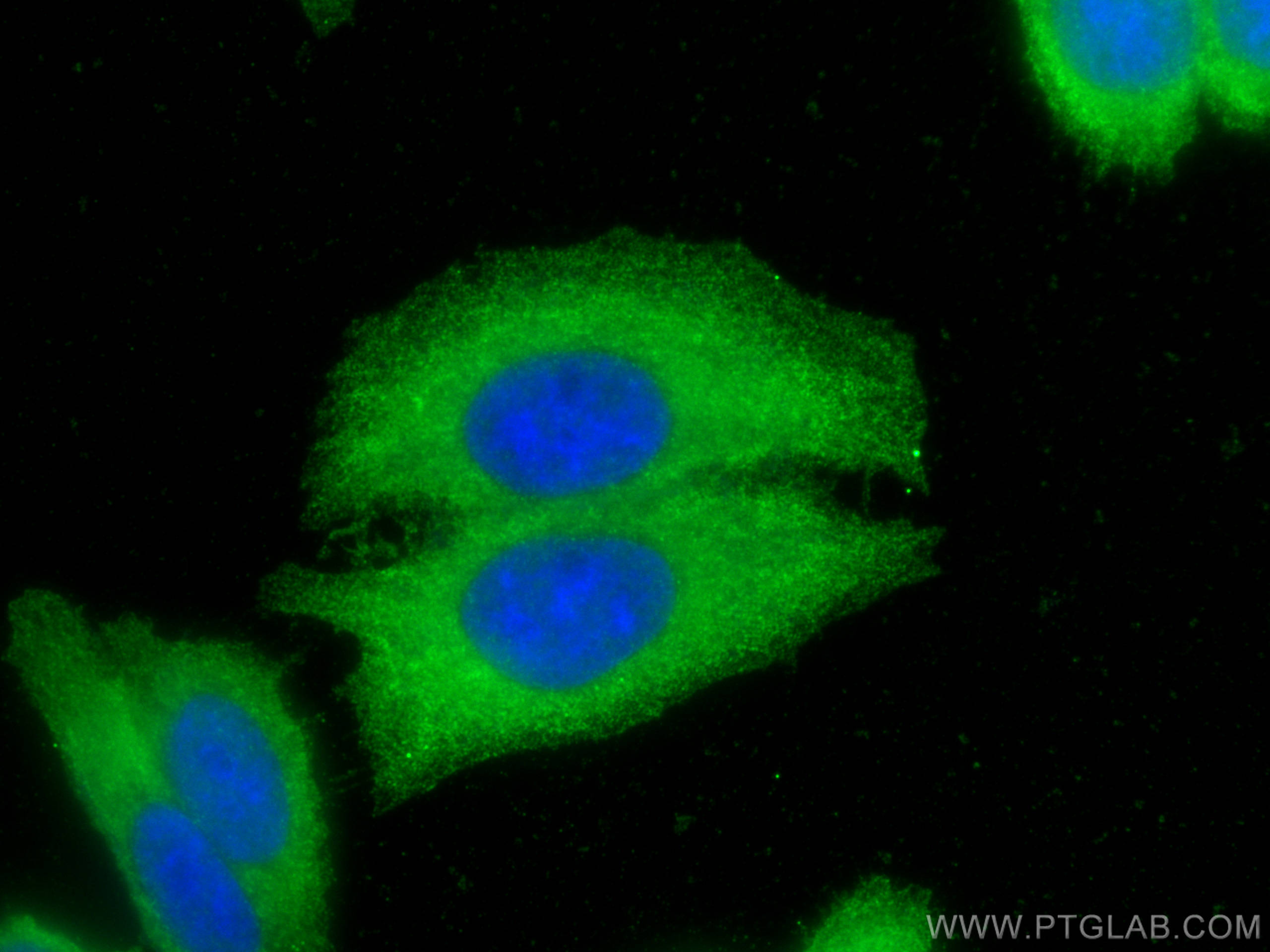 IF Staining of HepG2 using 12755-1-AP