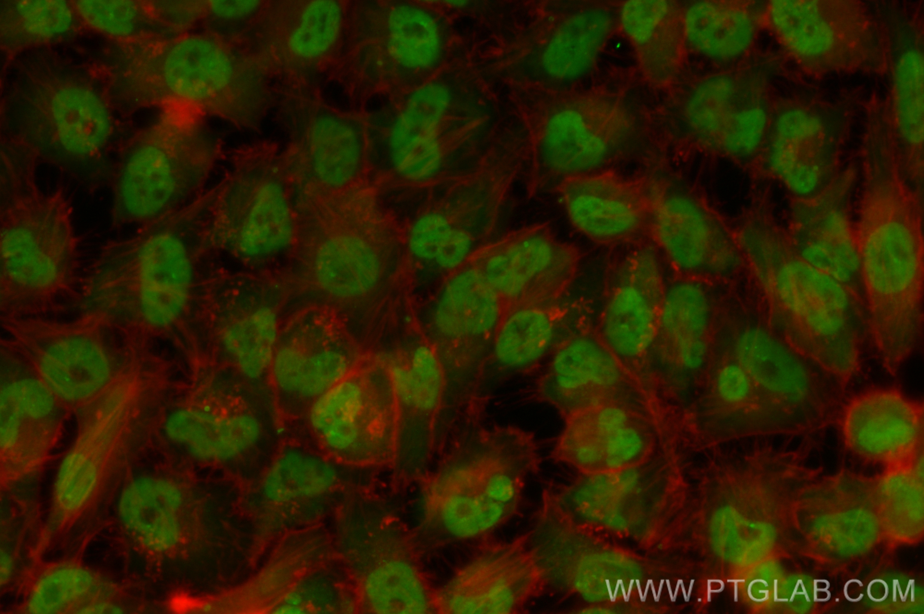 IF Staining of Hela using CL488-83113