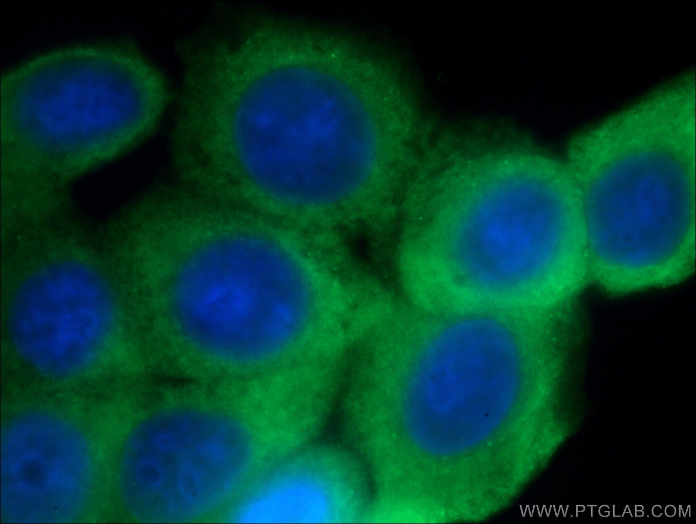 IF Staining of MCF-7 using 16371-1-AP