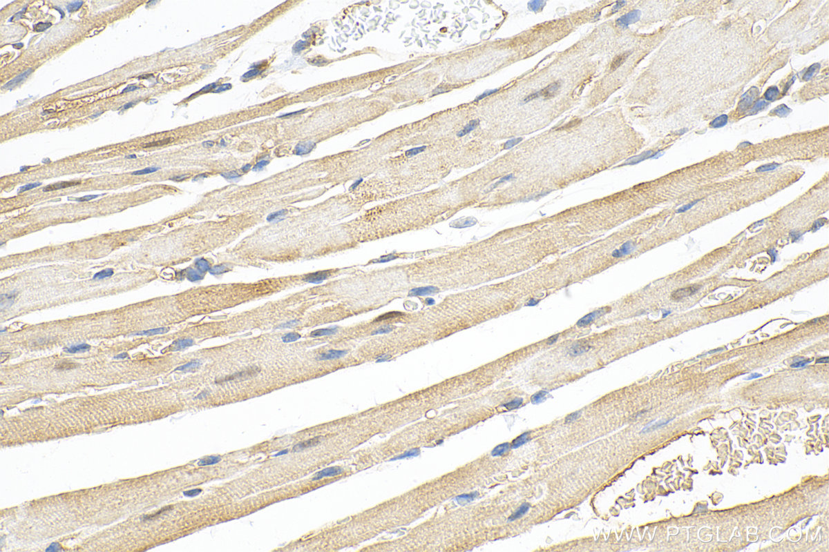 IHC staining of mouse heart using 15869-1-AP