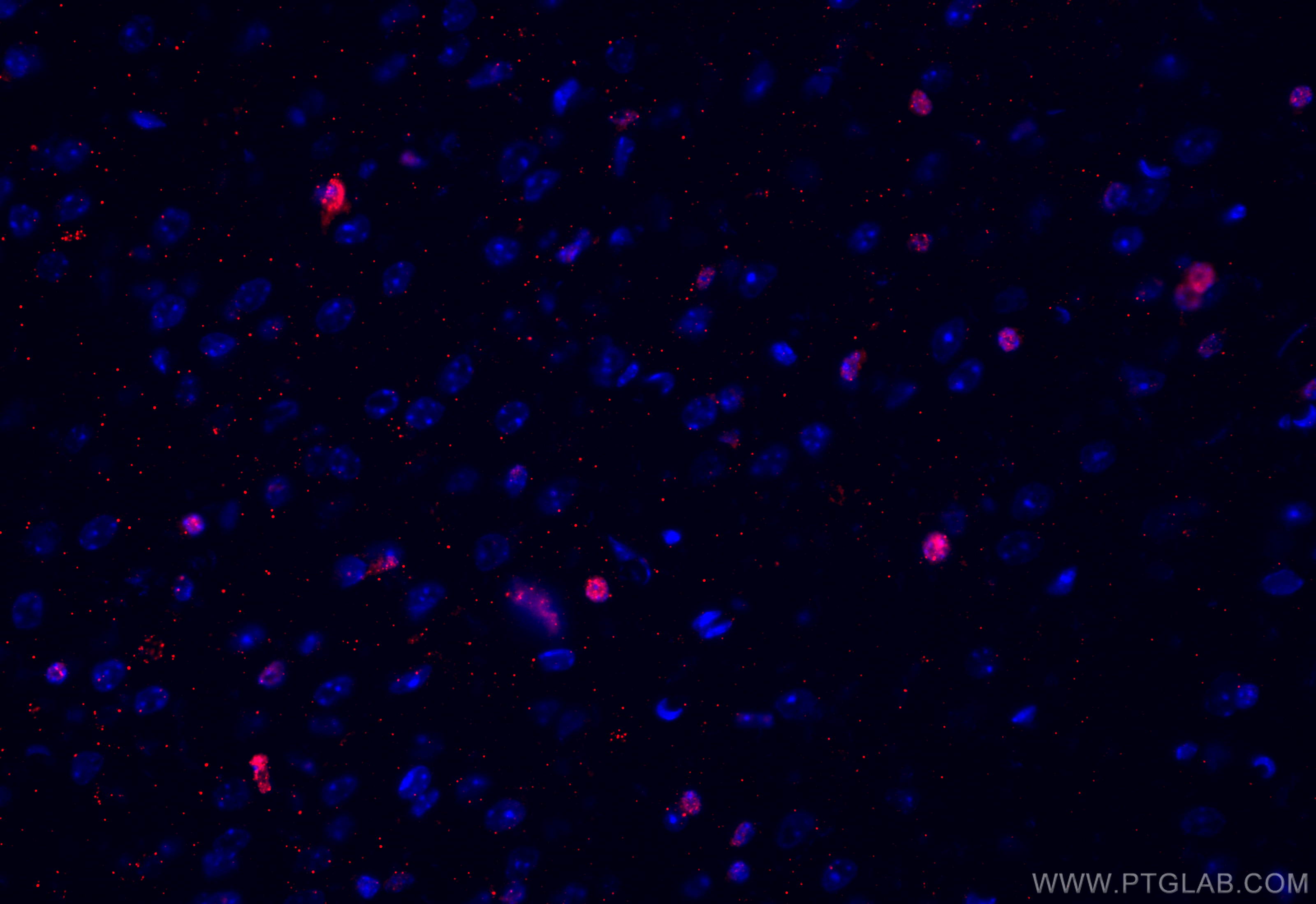 IF Staining of mouse brain using 13999-1-AP