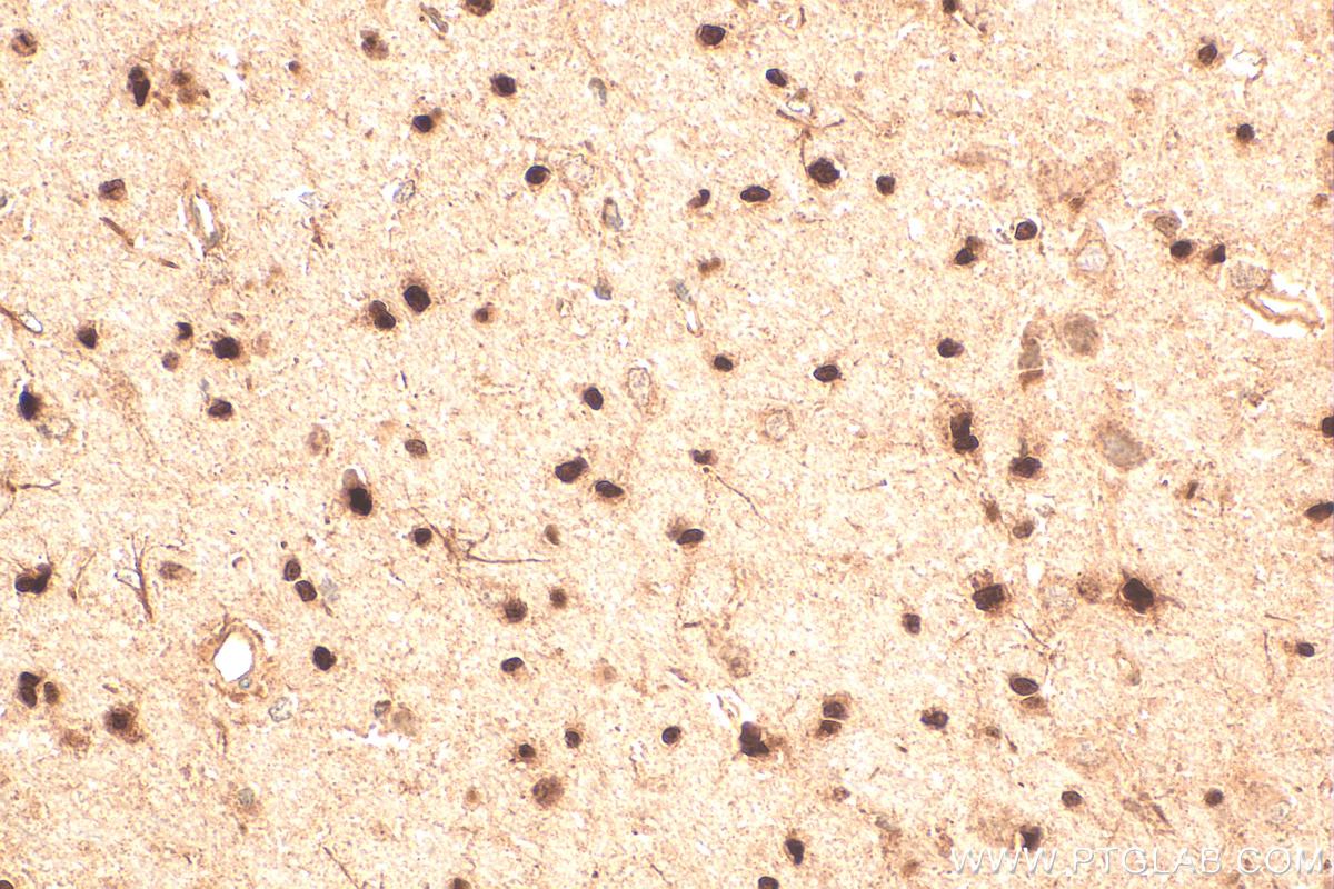 IHC staining of rat brain using 13999-1-AP