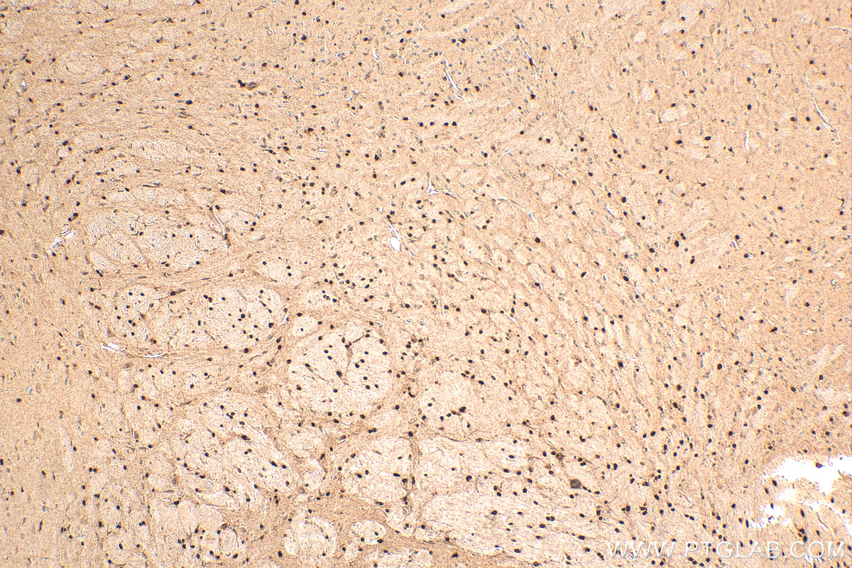 IHC staining of mouse brain using 13999-1-AP