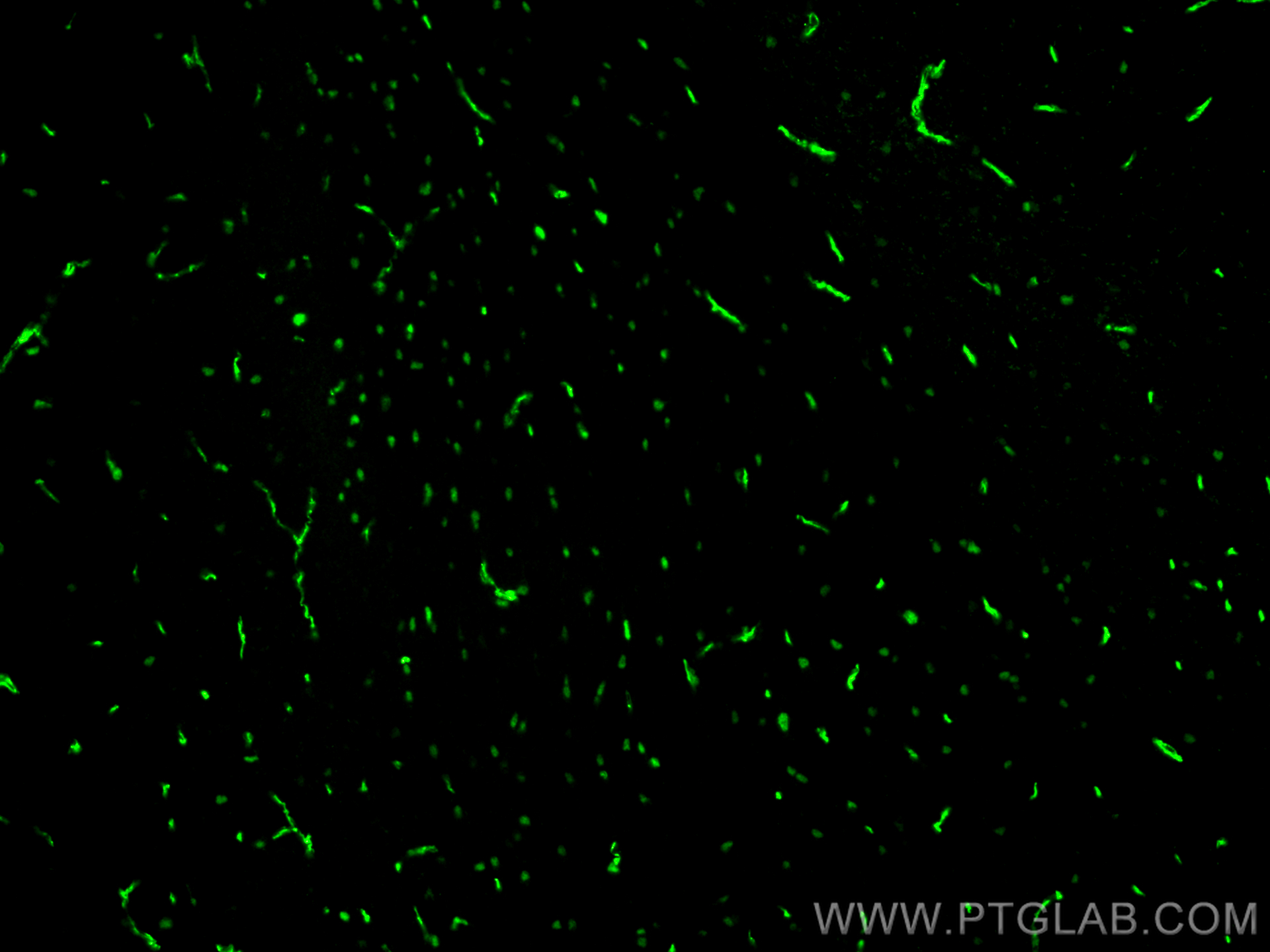 IF Staining of mouse brain using 25754-1-AP