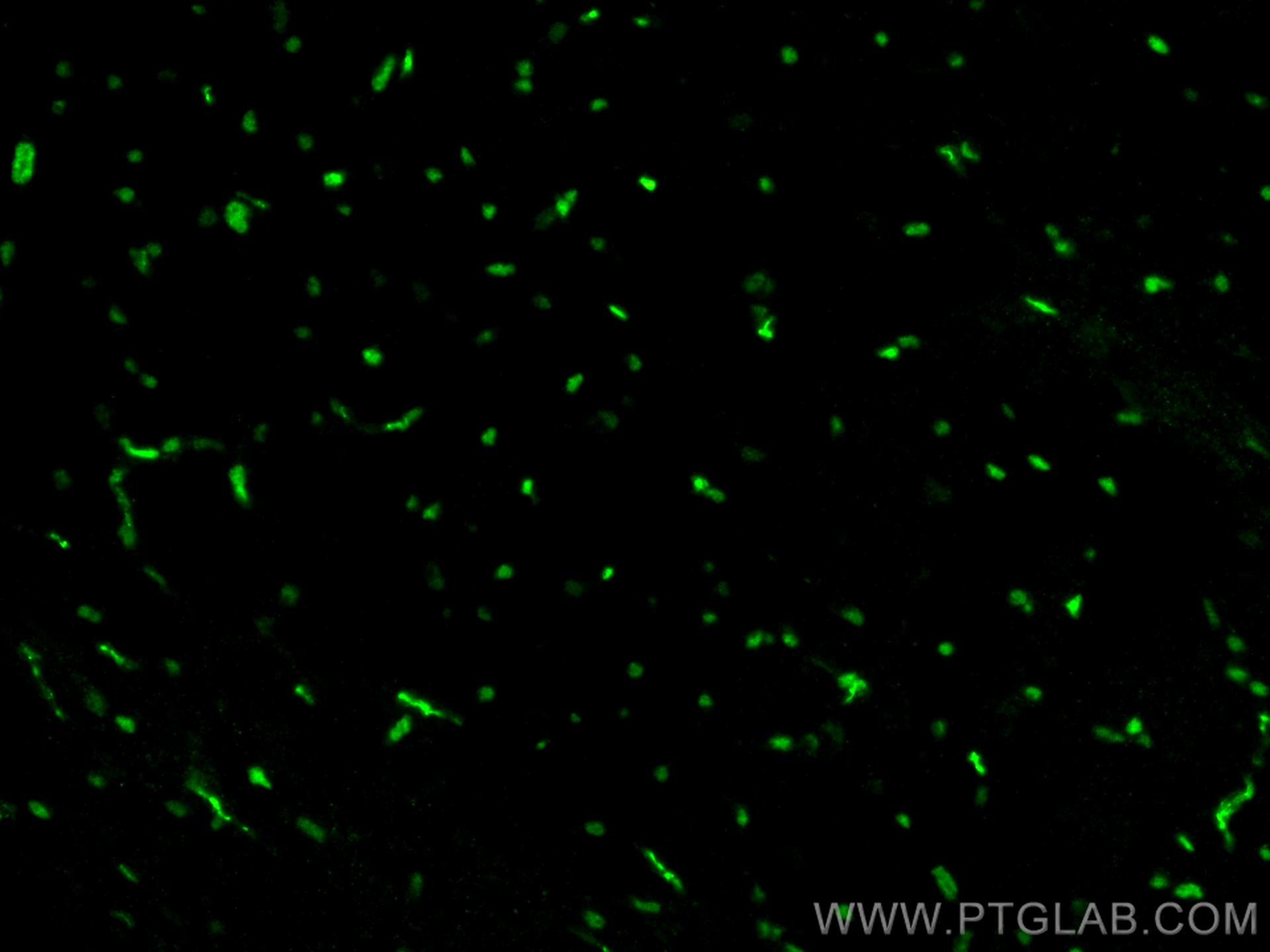 IF Staining of mouse brain using 25754-1-AP