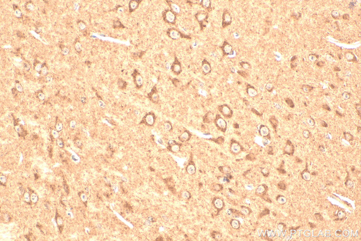 IHC staining of mouse brain using 27733-1-AP