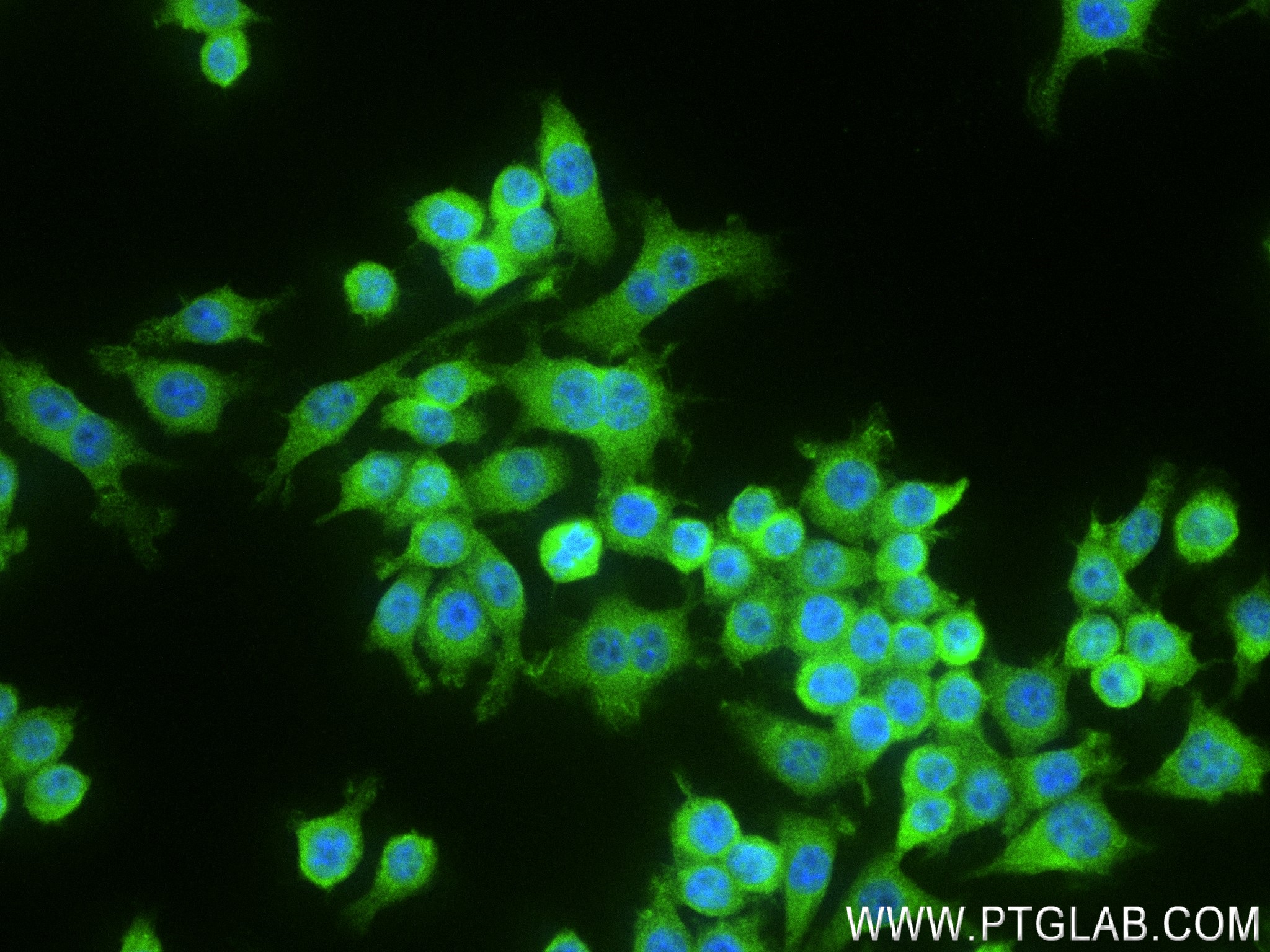 IF Staining of RAW 264.7 using 83341-1-RR (same clone as 83341-1-PBS)